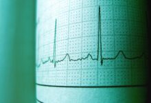 stellar pulse start rise