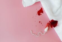 health topic heavy menstrual bleeding trends