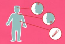 testing for homorzopia disease details